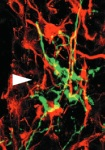Thumbnail of colored brain scan.